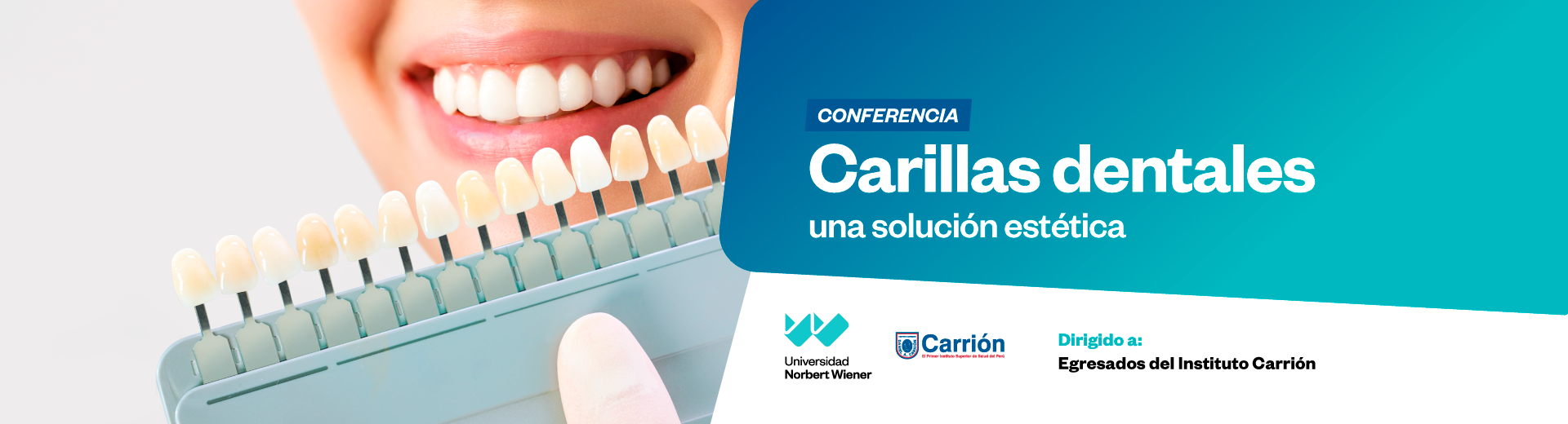 Carillas dentales una solución estética